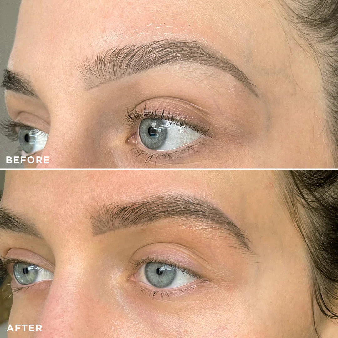 Before and after shot of model Brow Gold Nourishing Growth Oil 3